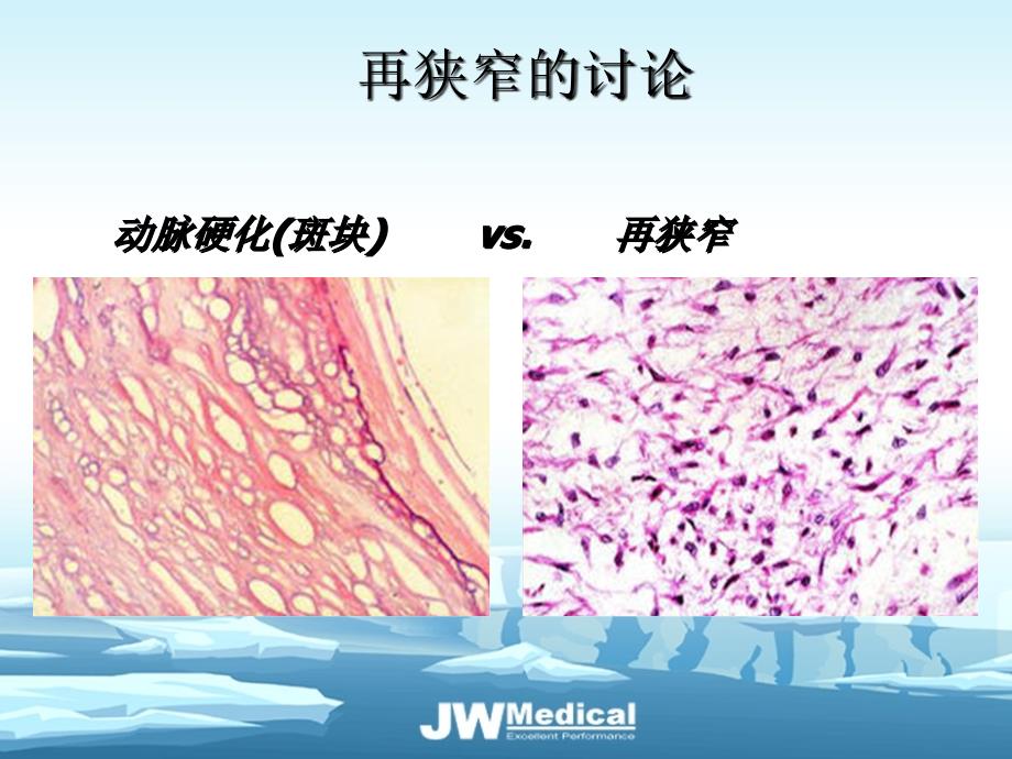 常用支架的特点_第1页