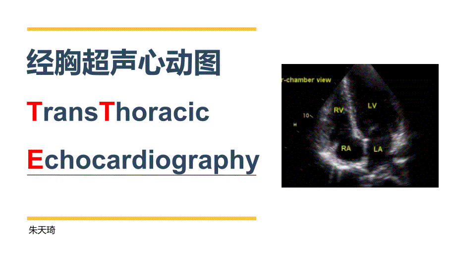 《经胸超声心动》PPT课件_第1页