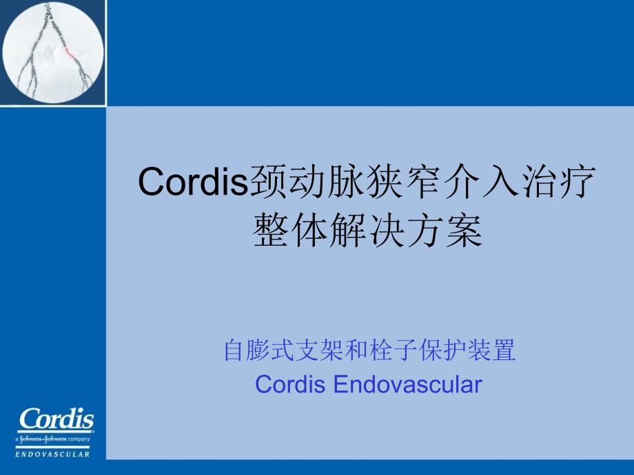 Cordis颈动脉狭窄介入治疗整体解决方案_第1页