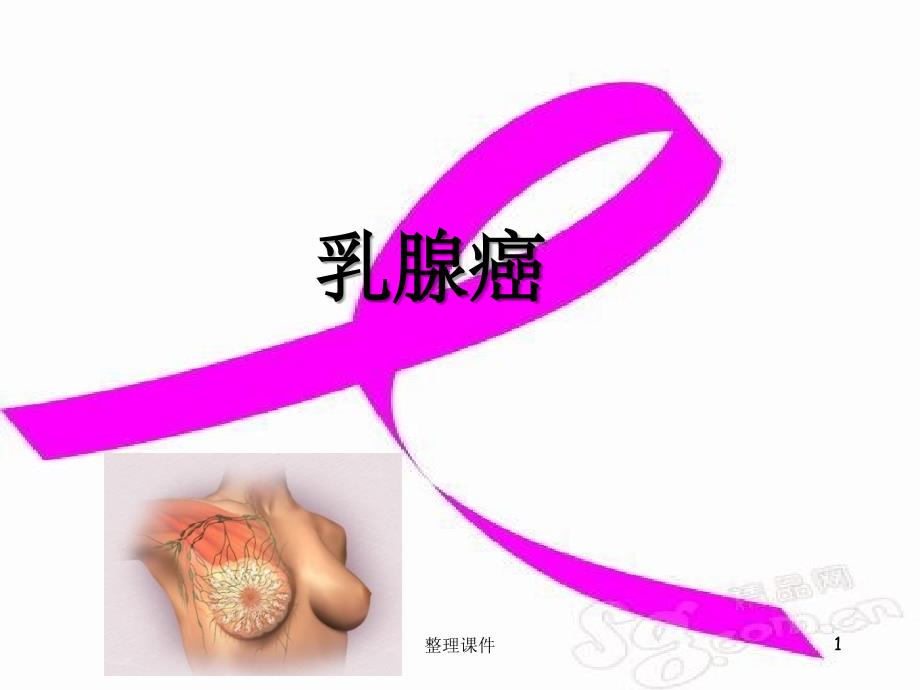 乳腺癌业务学习课件_第1页