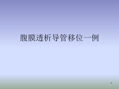 腹膜透析導(dǎo)管移位病歷分享ppt參考課件