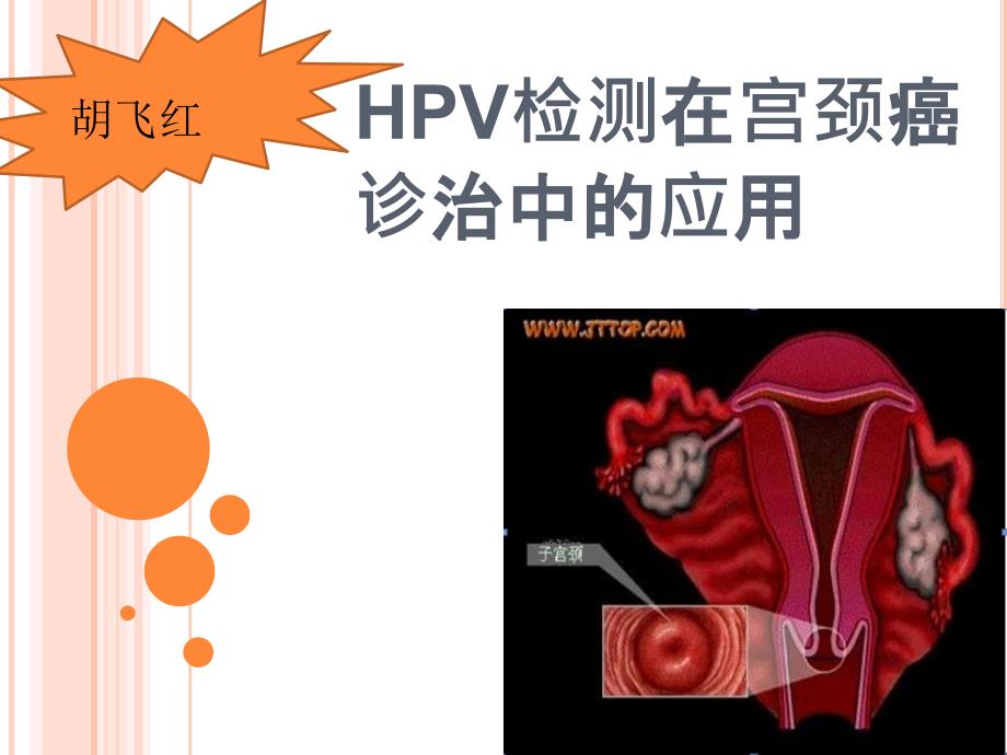 《HPV型别检测》PPT课件_第1页