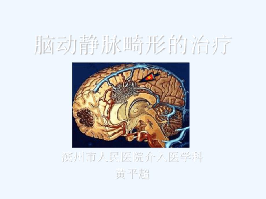 脑动静脉畸形的治疗课件_第1页