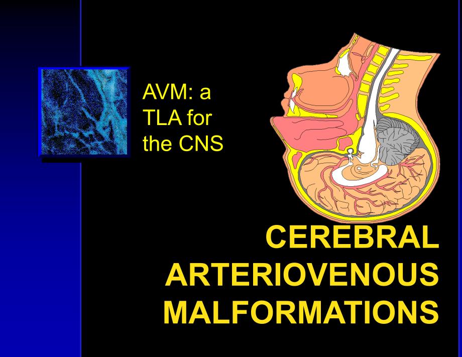 《脑动静脉畸形》PPT课件_第1页