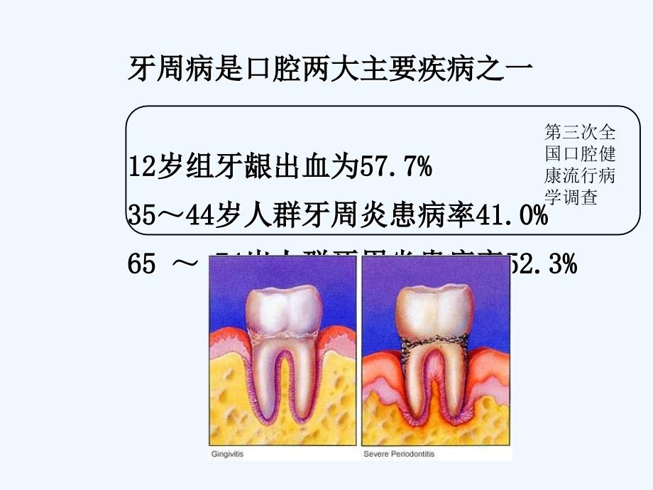 牙周病的修复治疗课件_第1页