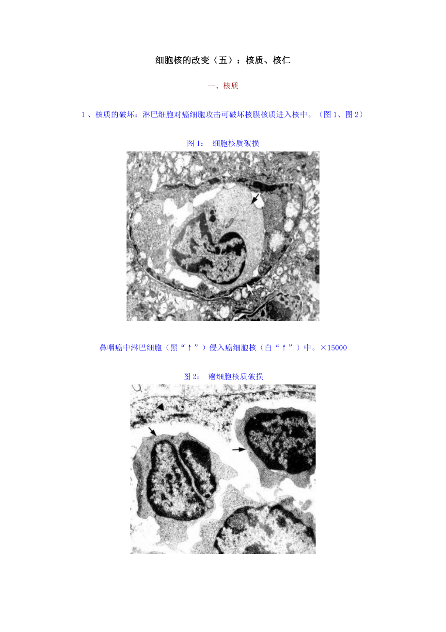 细胞核的改变(五)--核质、核仁_第1页
