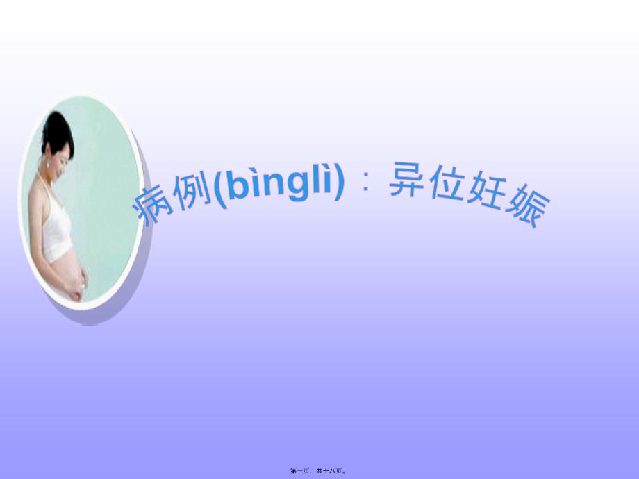 2022年醫(yī)學(xué)專題—異位妊娠病例討論ppt_第1頁