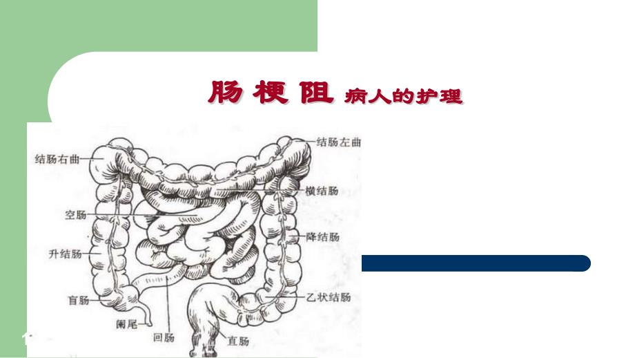 外科護(hù)理學(xué)-腸梗阻病人的護(hù)理ppt參考課件_第1頁