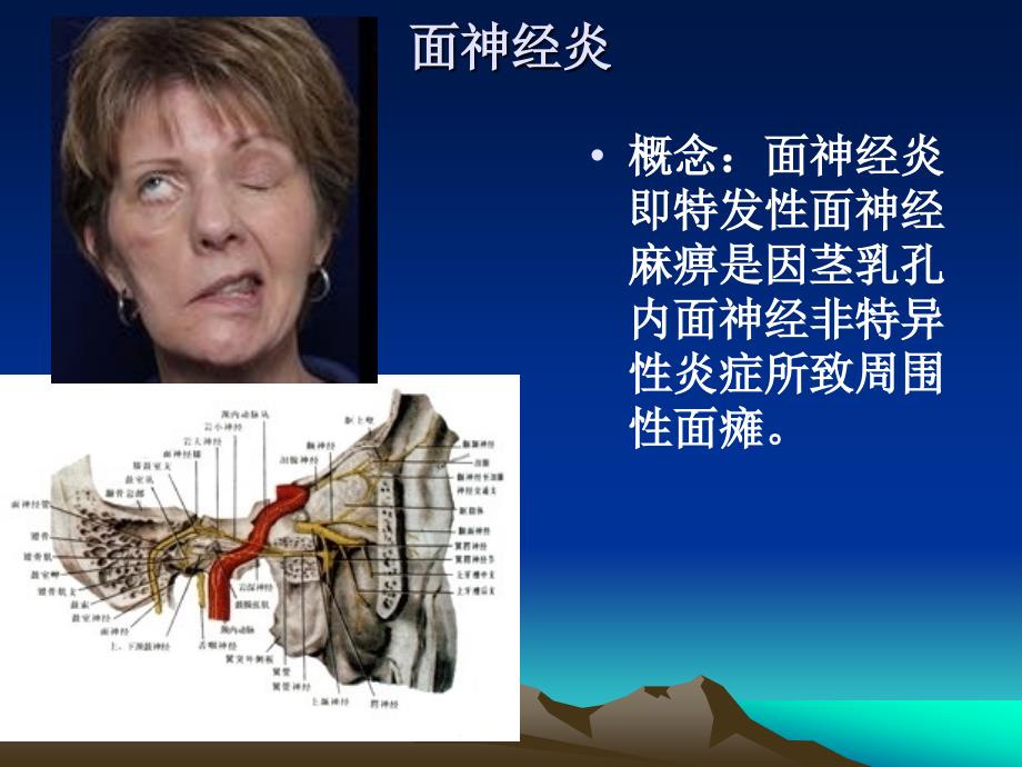 神经系统疾病及药物课件_第1页