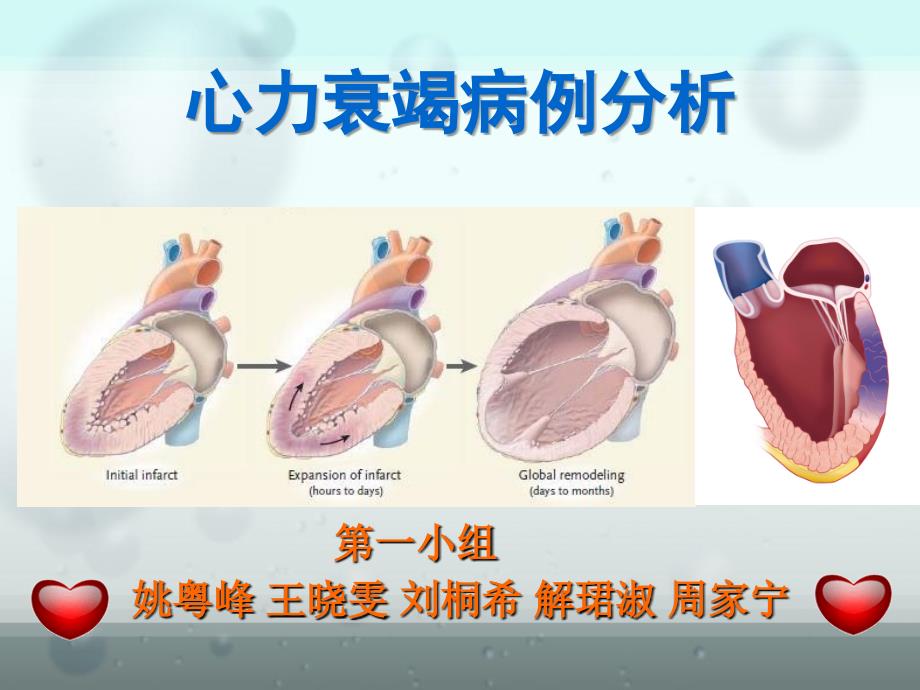 心力衰竭病例分析_第1页