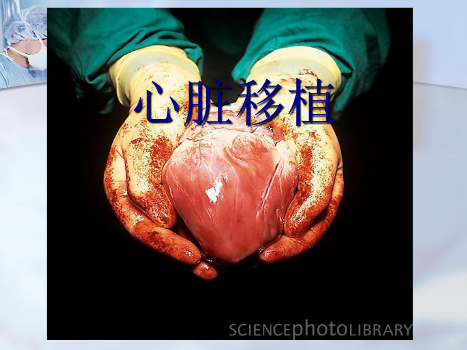医药卫生心脏移植课件_第1页