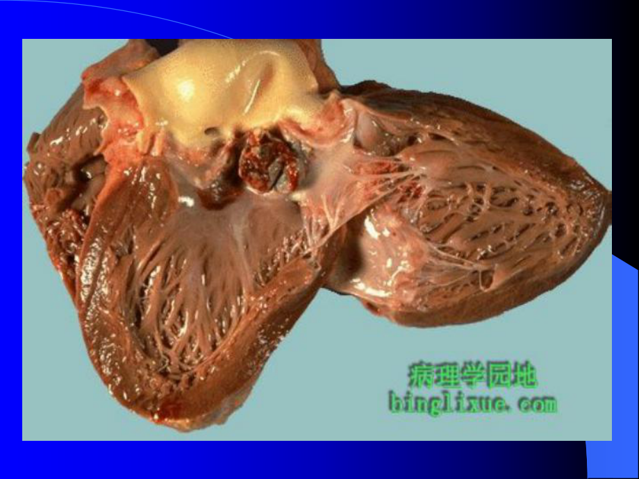 病理实验考：实验五_第1页