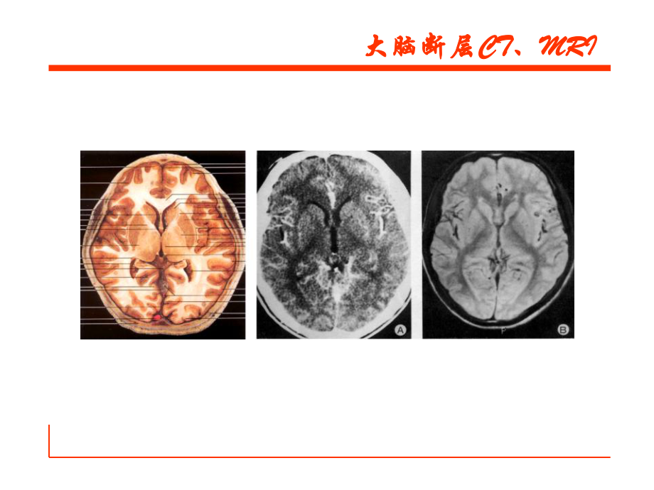 解剖学笔记：听觉多媒体教案_第1页