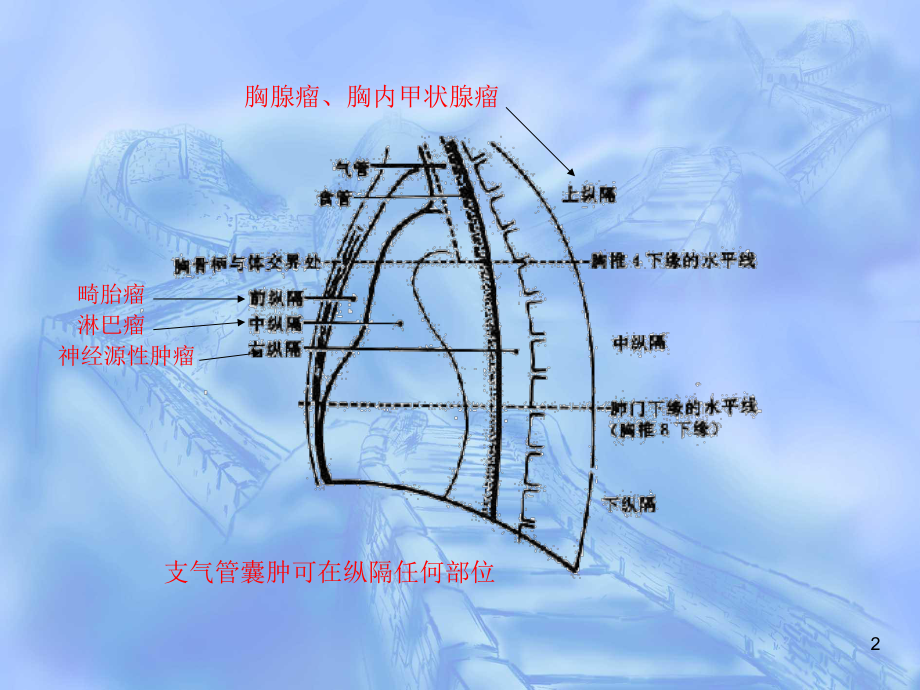 ct纵隔淋巴结分区ppt课件