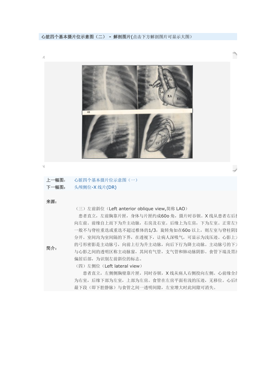 心脏四个基本摄片位示意图(二) - 解剖图片_第1页