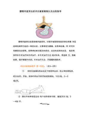 腰椎间盘突出症术后康复锻炼以及出院指导