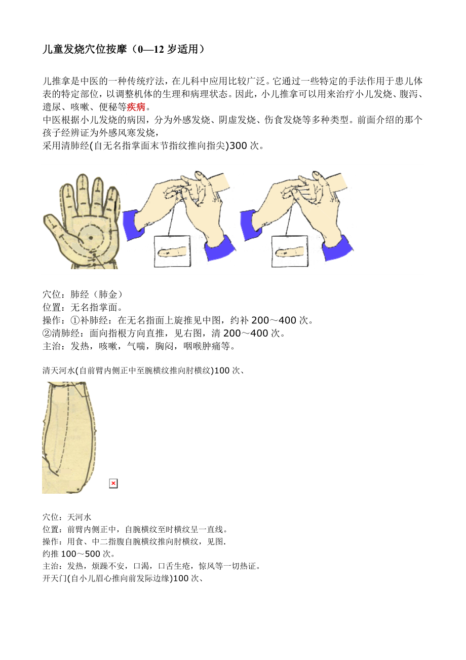 儿童发烧穴位按摩_第1页