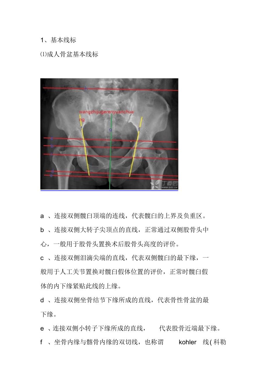 【精编】骨盆及髋关节X片的划线_第1页