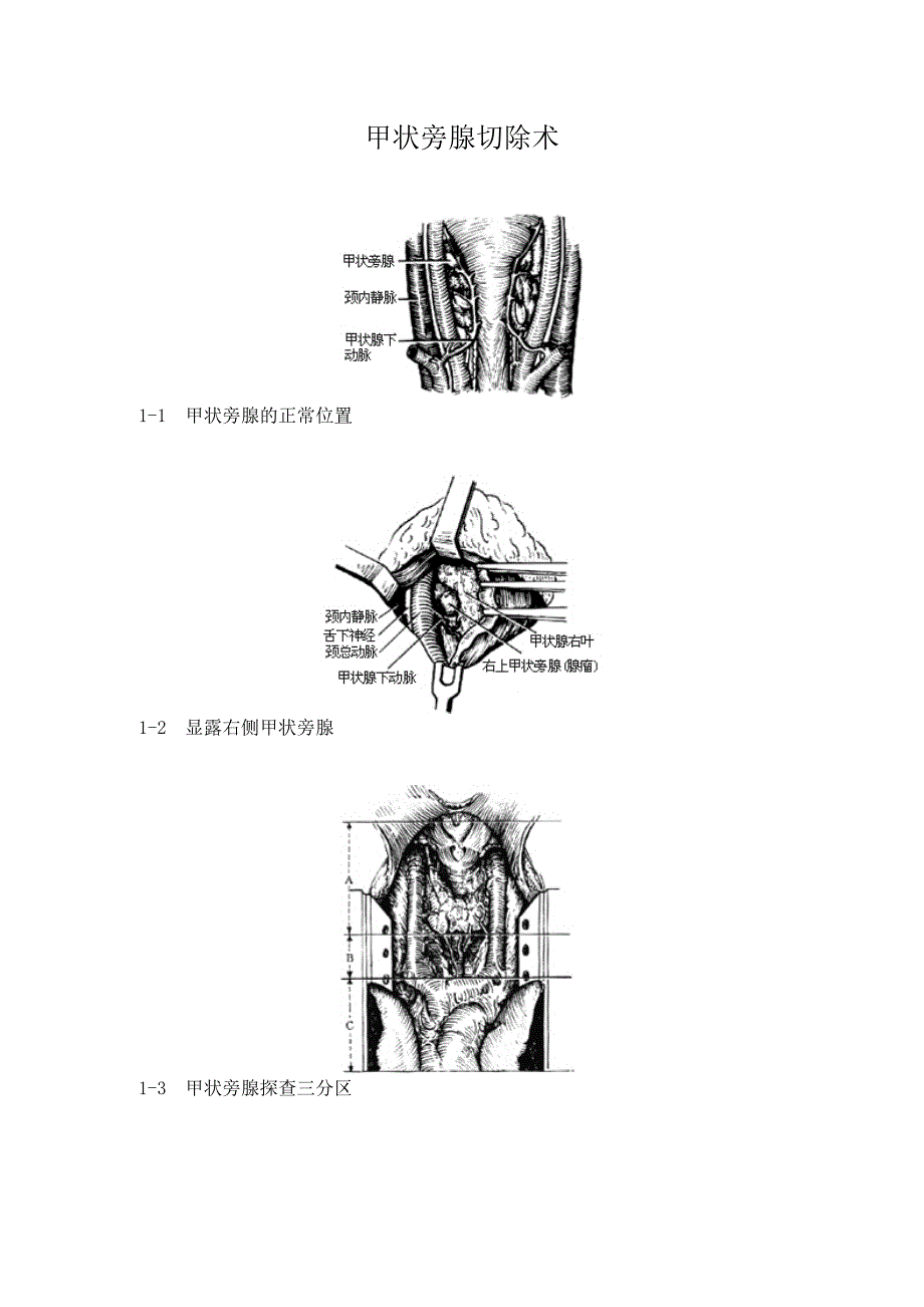 甲状旁腺切除术图谱_第1页