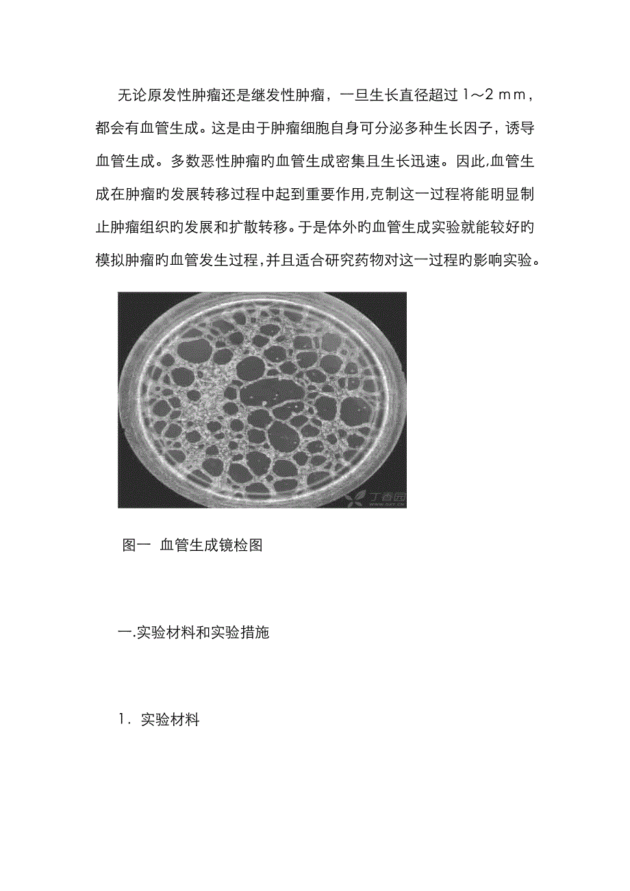 血管生成实验步骤-实验方法完善版_第1页