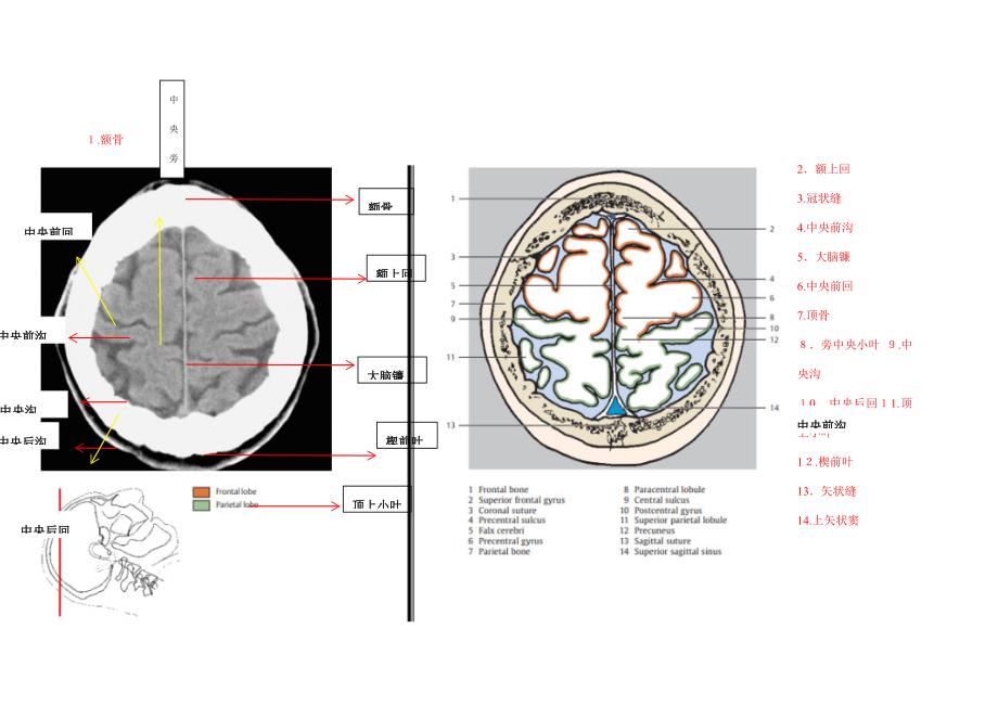 颅脑CT对照图谱_第1页