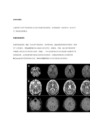 脑卒中影像学鉴别诊断(四)：特殊病灶分布模式